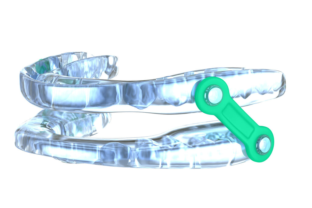 Dental Sleep Appliance image1