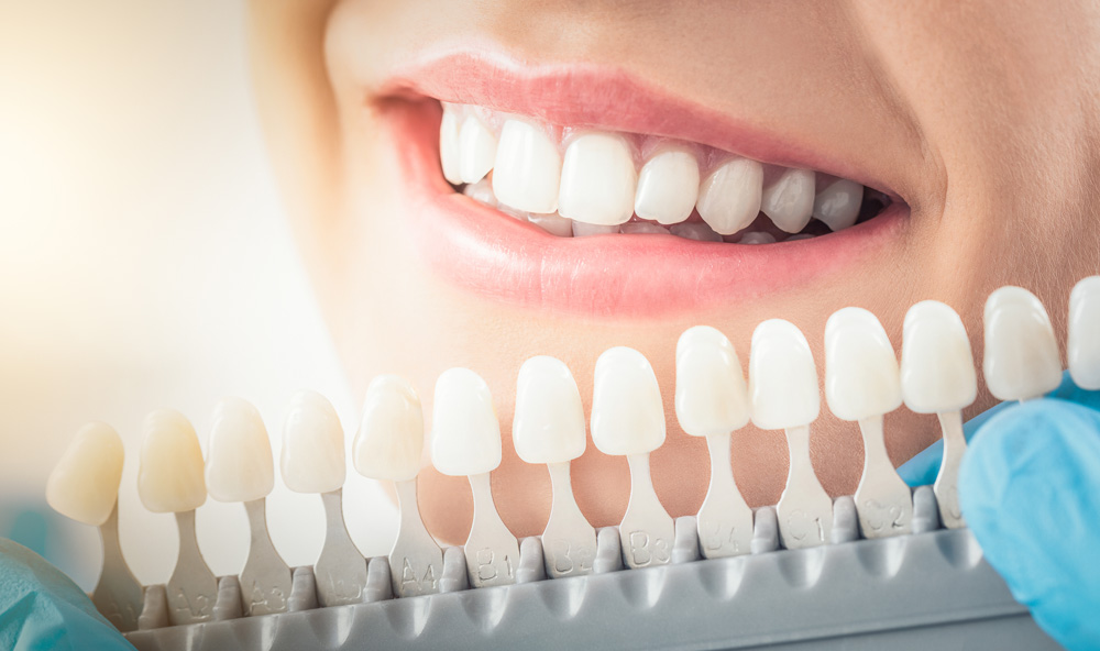 stock photo beautiful smile and white teeth of a young woman matching the shades of the implants