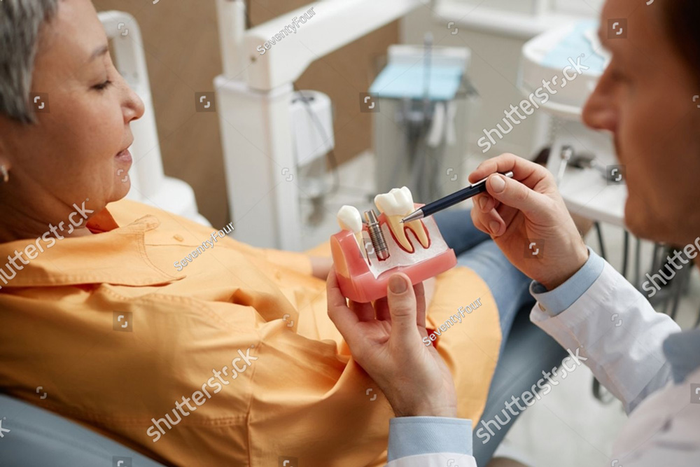 stock photo closeup of male dentist holding tooth model while explaining dental implant surgery to patient in 2300975361